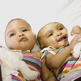 Eleven-month-old conjoined twins have been successfully separated.