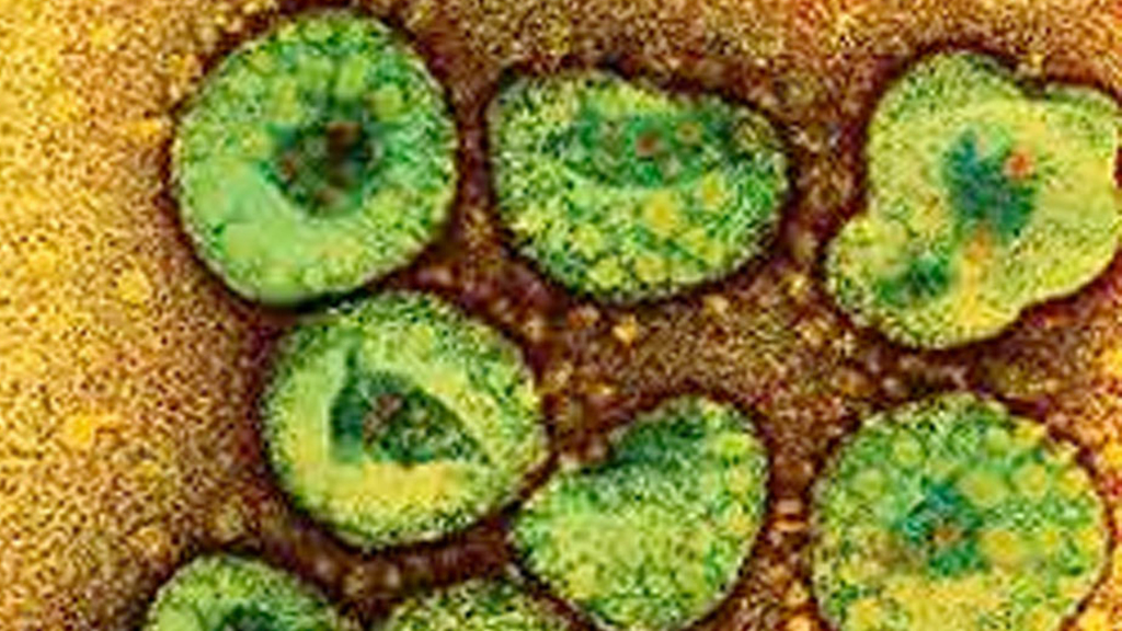 New coronavirus sparks public health alert (Reuters)
