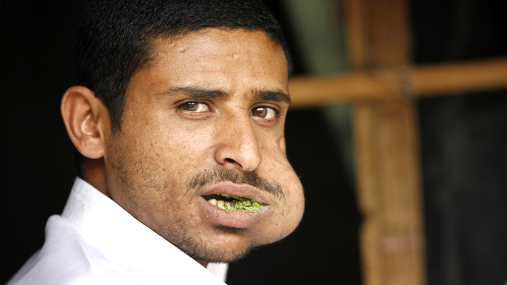 Government advisors rule out drug ban on khat (R)