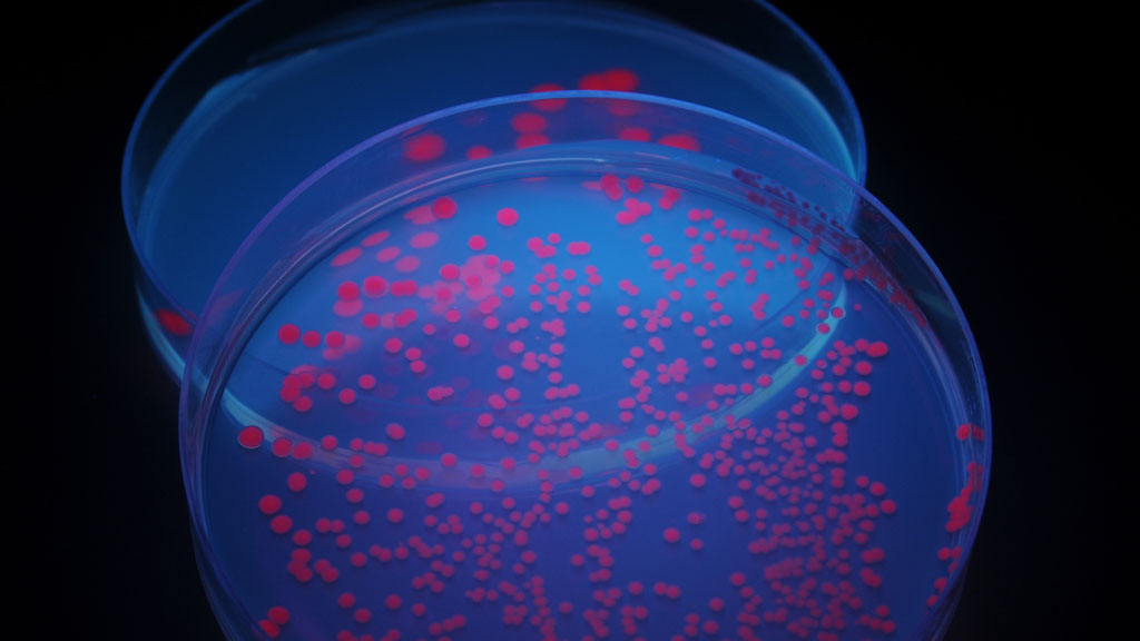 Bacteria in a petrie dish (Getty)