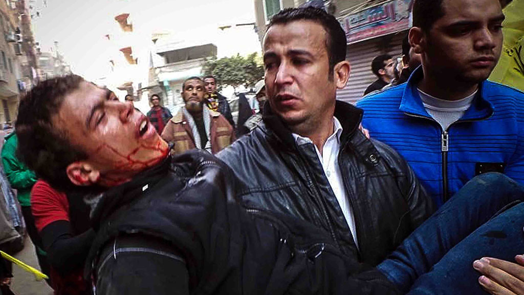 A man injured in clashes between anti-government protesters and supporters of the military government (picture: Getty)