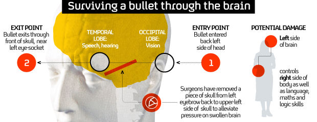 Arizona shooting: Gabrielle Giffords survived a bullet through her brain.