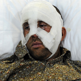 Libya: an inured man awaits treatment in Benghazi after being evacuated from Misrata (Getty)