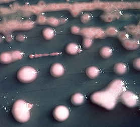 Superbug New Delhi metallo-&#223;-lactamase, NDM-1