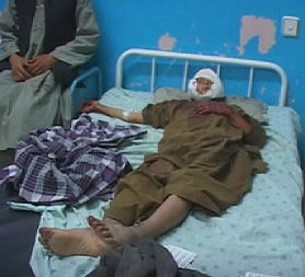 Wounded wedding guests treated after Afghan blast