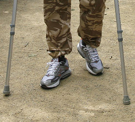 British soldier with leg injuries from Afghanistan. Reuters